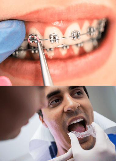 Orthodontist Doctors in Uttarahalli