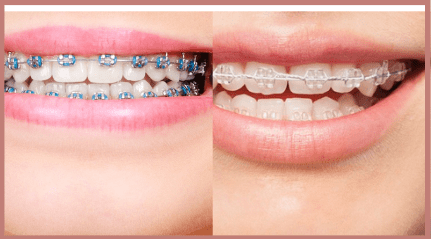 Orthodontist Doctors in Uttarahalli